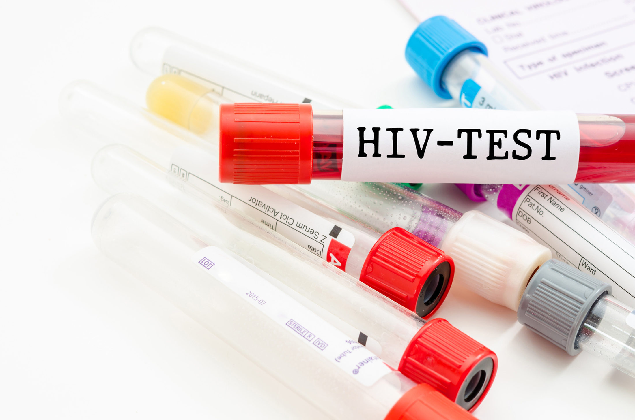 Few Young People Have Access to HIV Tests - Financial Tribune
