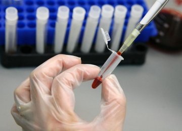  New Aggressive HIV Strain Detected in Cuba