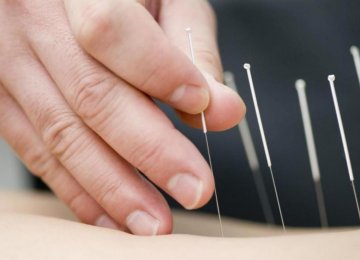  Acupuncture Effective 