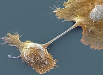 Cell Separator for Detecting Cancer