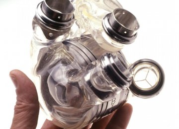 Artificial Heart Transplant Knowhow