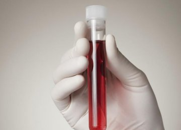 IBTS Lauds Iran Success  in Rare Blood Transfusion