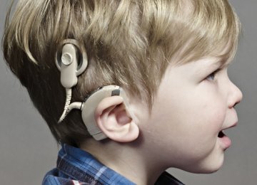 Congress on Cochlear Implant