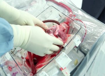 New Device Keeps Heart Beating After Death