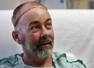 First Skull-Scalp Transplant From Human Donor
