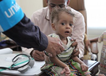 A boy is treated for malnutrition in Yemen. (File Photo)