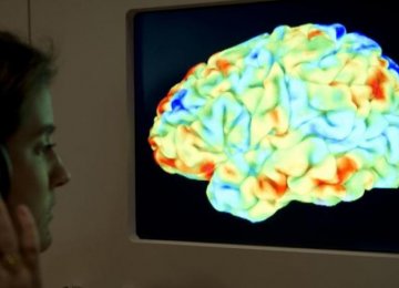 Concussion May Accelerate Alzheimer’s