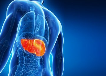 Among patients with chronic HCV infection, approximately one-third progress to cirrhosis, a condition in which the liver does not function properly.