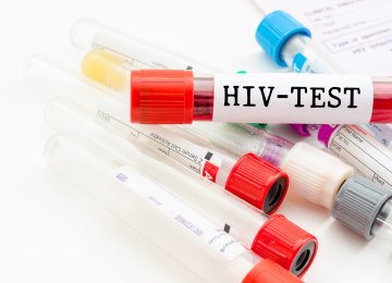 Few Young People Have Access to HIV Tests