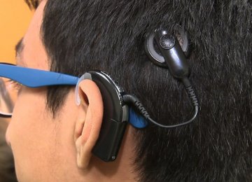 No Long Wait for Cochlear Implants