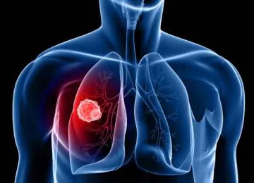 Lung Diseases Claiming More lives