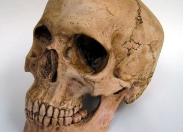 Ancient Skull Unearthed in Tehran