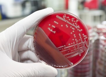 End of the Road for Antibiotics?