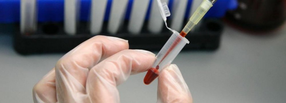  New Aggressive HIV Strain Detected in Cuba