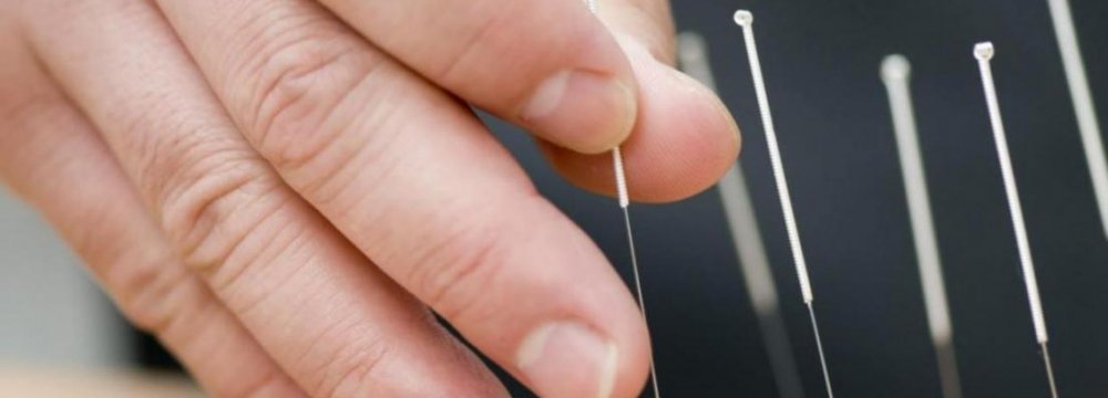  Acupuncture Effective 