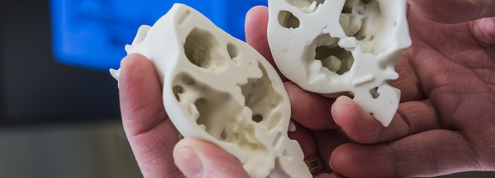 Surgeon Uses 3D Printed Heart for Surgery