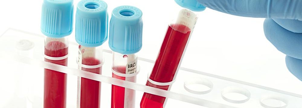 Lab-Made Blood to Enter Human Trials in 2 Years