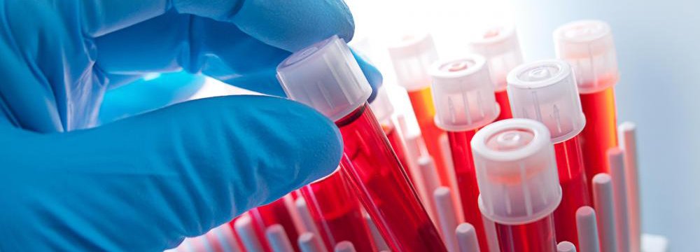 Rapid Blood Test May Cut Antibiotics Misuse