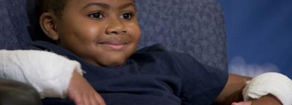 Youngest Person Gets Double Hand Transplant