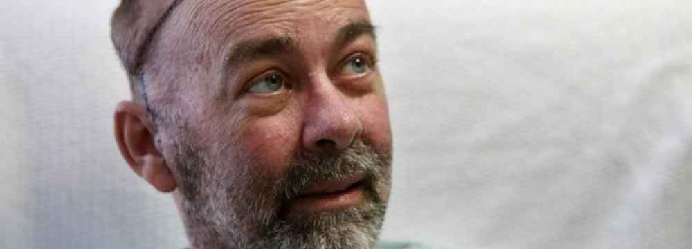 First Skull-Scalp Transplant From Human Donor