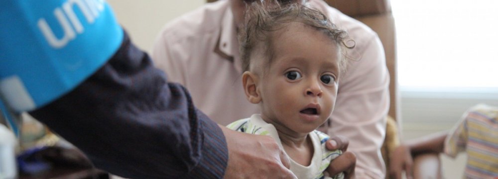 A boy is treated for malnutrition in Yemen. (File Photo)