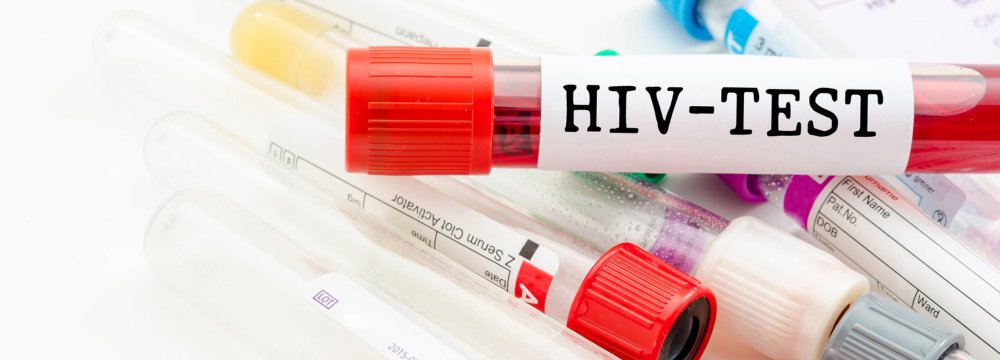 Few Young People Have Access to HIV Tests