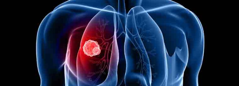 Lung Diseases Claiming More lives