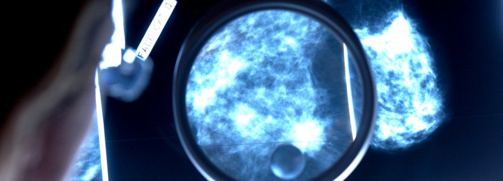 Deaths from breast cancer would fall by an average of 40% with annual screenings from 40 to 84.