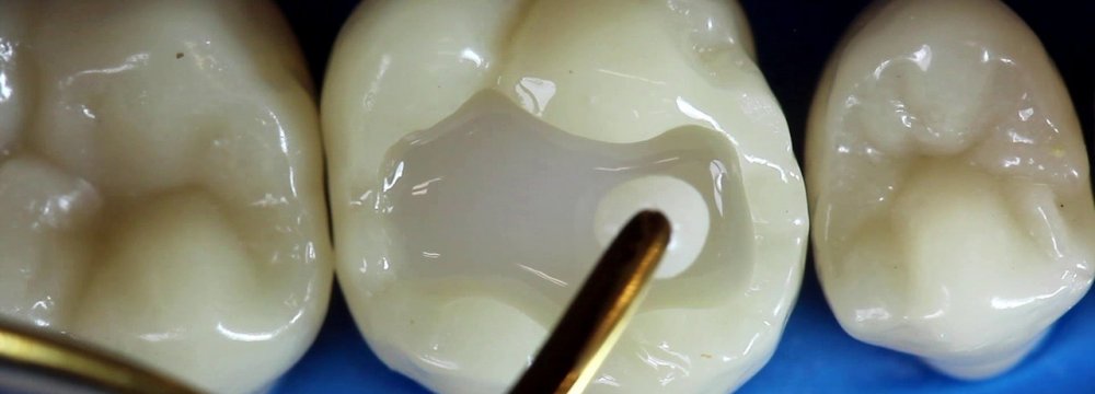 Natural Tooth Repair Method