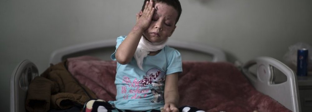 Hawra Alaa Hassan, 4 years old, who was badly  burnt in a US airstrike in Mosul, is seen in  a hospital in Irbil, Iraq, on April 8. (File Photo)