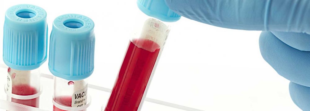 23 Rare Blood Types Identified