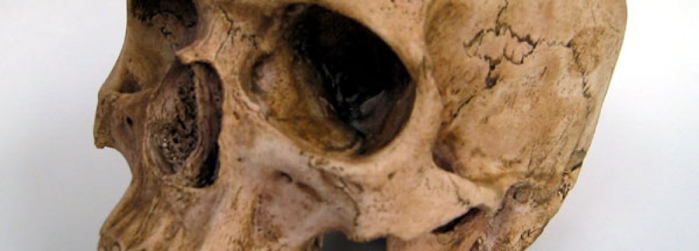 Ancient Skull Unearthed in Tehran